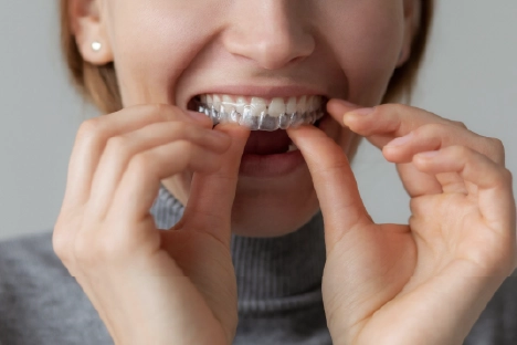 A woman smiling with braces